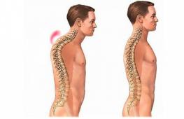 Укрепление мышц спины при остеохондрозе, сколиозе, для исправления осанки, при болях в спине и пояснице